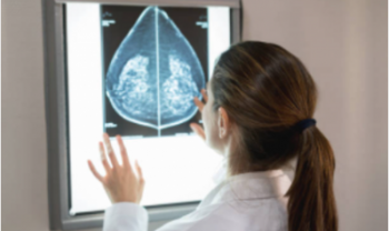 Projeto prevê que laboratórios privados notifiquem o SUS ao detectar casos de câncer de mama e de útero